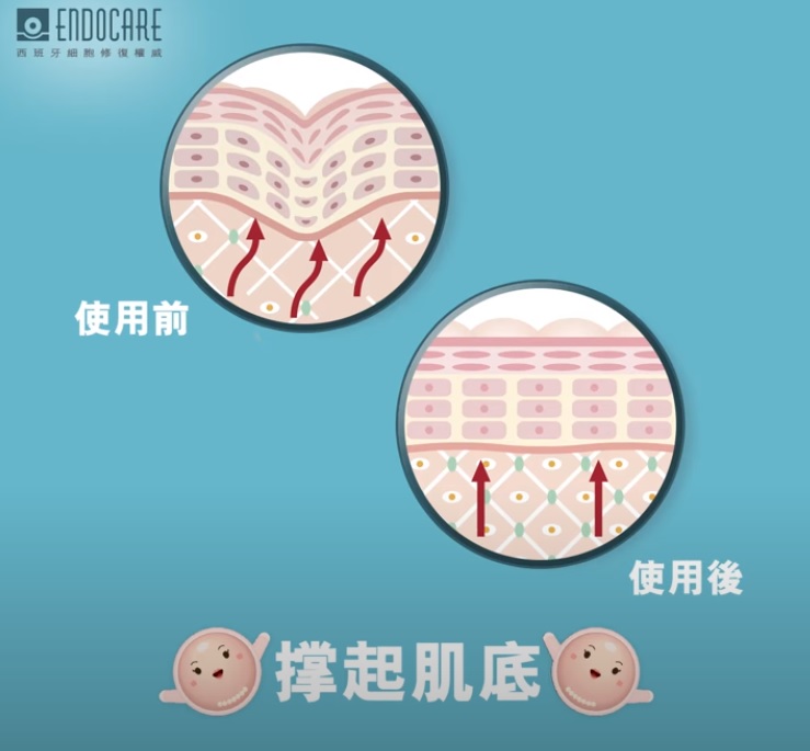 使用方法： 日常保養：早晚潔面後，各取半支塗抺面部和頸部肌膚  妝前急救：於妝前使用半支塗抺面部，高效持久保濕，貼妝不浮粉  美容療程：療程前： 打底增強療程效果  療程後：舒緩修復細胞，再生柔滑嫩肌  旅途護理：隨時塗抺，解決機艙空氣乾燥肌膚缺水及戶外日曬後肌膚受損的問題